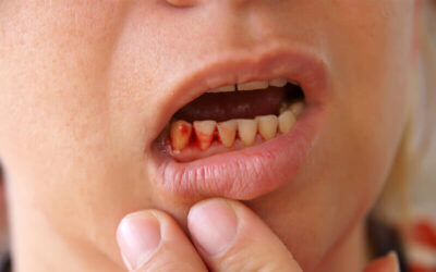 11 Every day Brushing Habits that Damage Your Gums and Teeth