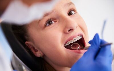 Difference Between Plaque vs. Calculus: Understanding the Distinction
