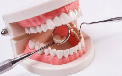 What Are Immediate Dentures?