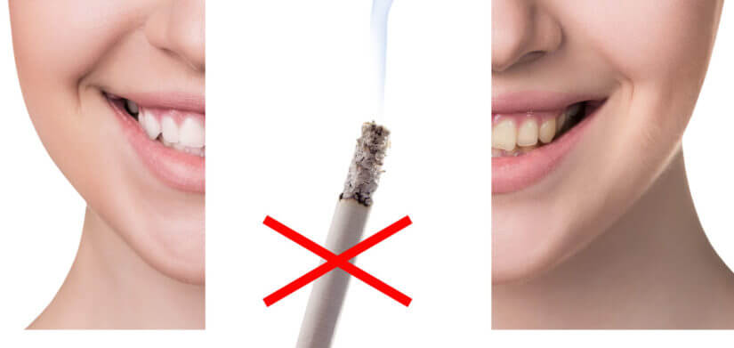 How Tobacco Ruins Your Dental Health