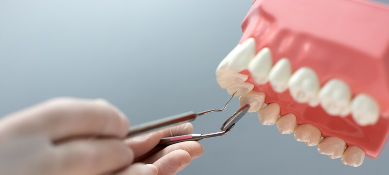 Speed Up Your Recovery From Dental Implant Surgery