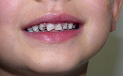 Top 20 Oral Health Issues- You Need To Take Care About Them