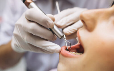 Why You Should Think Twice Before Getting an Oral Piercing
