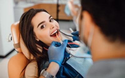 The Top 7 Benefits of Porcelain Veneers