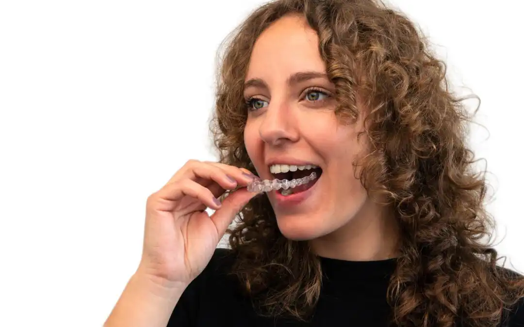 Why Teeth Aligners Are Used And Types Of Teeth Aligners
